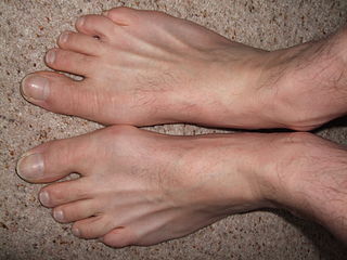 Pickleball - Aim For The Feet